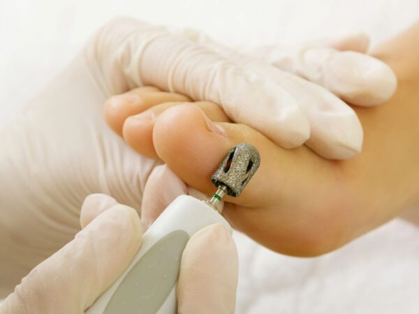 Pedicure behandeling