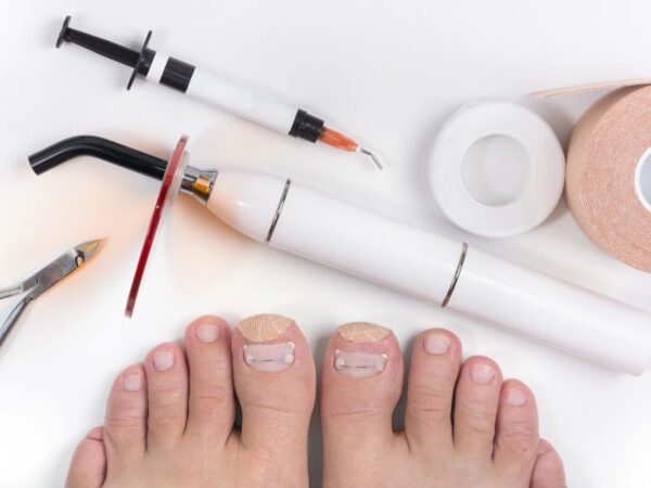 Specialistische technieken